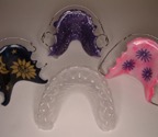 RETAINERS (REMOVABLE)