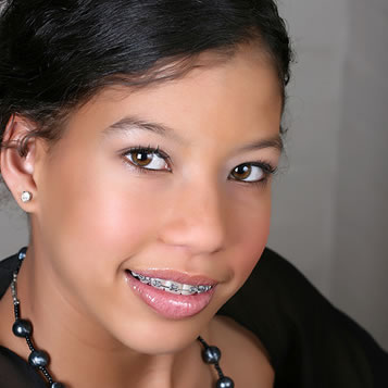 Metal Braces - Grey Orthodontics | Mandeville Jamaica